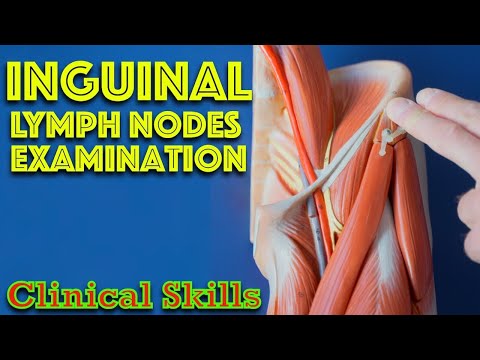Видео: Паховые лимфатические узлы — объяснение клинического обследования — д-р Гилл