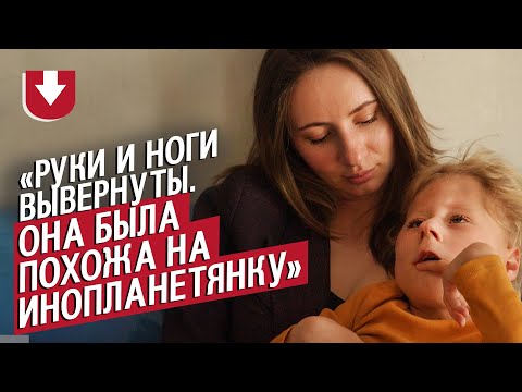 Видео: У моей дочери синдром Кагами-Огата: Ольга | Быть мамой