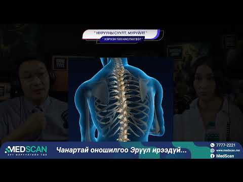 Видео: Нурууны суулт, муруйлт - ХЭРХЭН 100 НАСЛАХ ВЭ?