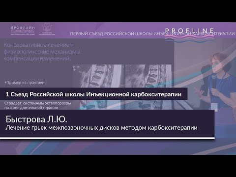 Видео: ЛЕЧЕНИЕ ГРЫЖ МЕЖПОЗВОНОЧНЫХ ДИСКОВ МЕТОДОМ КАРБОКСИТЕРАПИИ || Спикер: БЫСТРОВА ЛАРИСА ЮРЬЕВНА