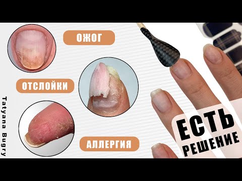 Видео: Отслойки ? Аллергия ? Ожог⚠️СТОП⚠️Есть РЕШЕНИЕ/ #ТатьянаБугрий