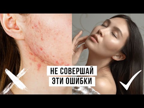 Видео: 10 ошибок в уходе за кожей лица. Почему появляются прыщи?