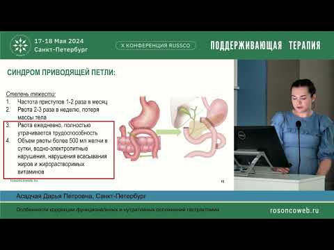 Видео: Особенности коррекции функциональных и нутритивных осложнений гастрэктомии
