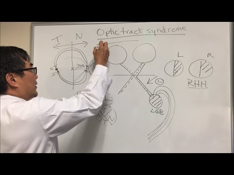 Видео: Синдром зрительного тракта