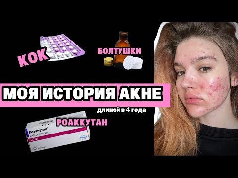 Видео: моя история АКНЕ // БОЛТУШКИ • КОК • РЕТИНОИДЫ • РОАККУТАН