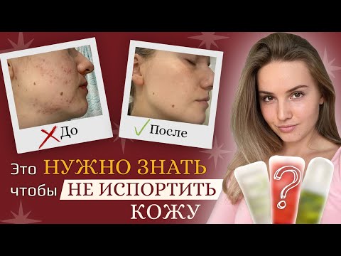 Видео: Как я избавилась от акне, закрытые комедоны, ошибки и советы, избавляемся от постакне, фототерапия