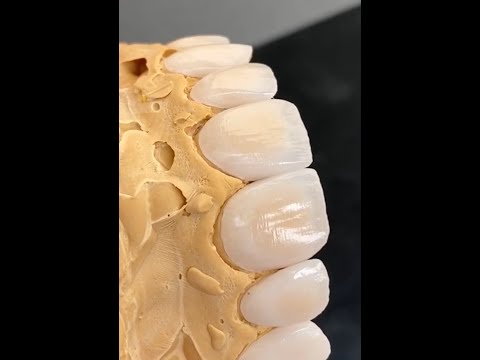 Видео: Feldspathic Техника нанесения керамики на рефракторе Noritake зубной техник dental technician