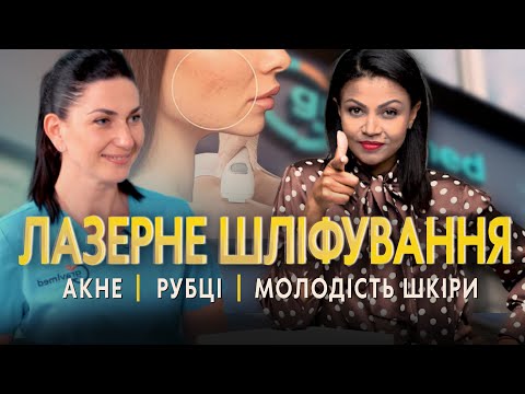 Видео: 🍓 🔬 Як позбутися ПОСТАКНЕ, шрамів, РОЗТЯЖОК на тілі?  Лазерне шліфування.