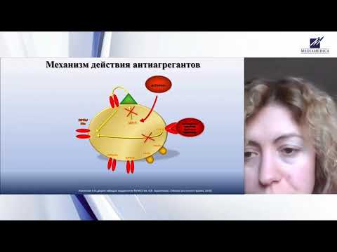 Видео: Дезагрегантная терапия при ОКС