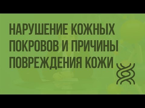 Видео: Нарушение кожных покровов и причины повреждения кожи. Видеоурок по биологии 8 класс