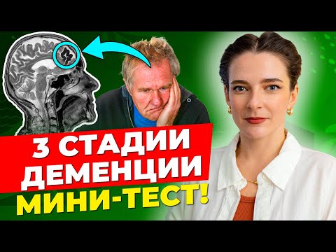 Видео: 3 СТАДИИ ДЕМЕНЦИИ || Пройди ПРОСТОЙ ТЕСТ! Это должен знать каждый!