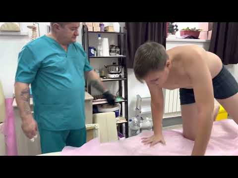 Видео: Разницу в длине ног в 3 см,у мальчика 12 лет убираем за сеанс