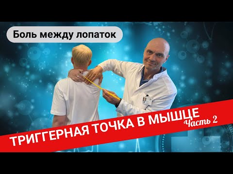 Видео: БОЛЬ МЕЖДУ ЛОПАТКАМИ. Триггерные точки в мышце. Лечение (Часть 2)