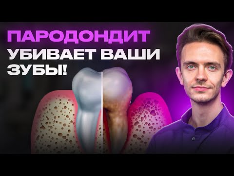 Видео: ГЛАВНЫЙ ВРАГ ЗУБОВ - ПАРОДОНТИТ. ЧТО ДЕЛАТЬ? КАК ЛЕЧИТЬ?