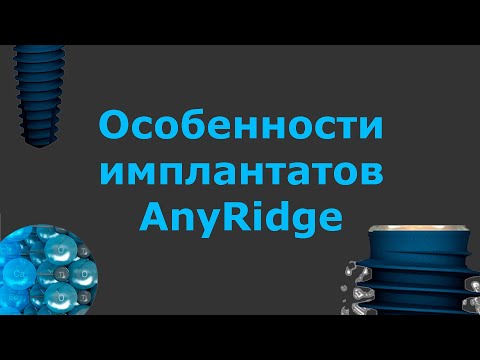 Видео: Имплантаты AnyRidge – Эниридж