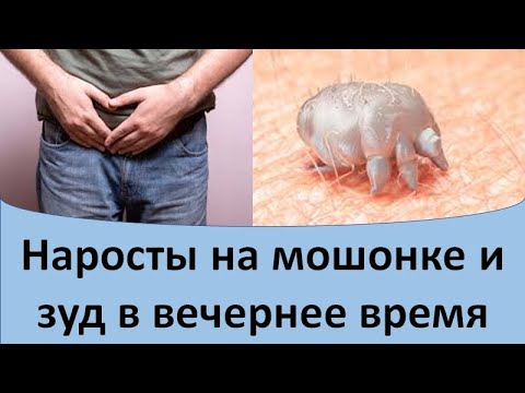Видео: Наросты на мошонке и зуд в вечернее время