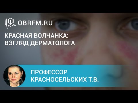 Видео: Профессор Красносельских Т.В.: Красная волчанка: взгляд дерматолога