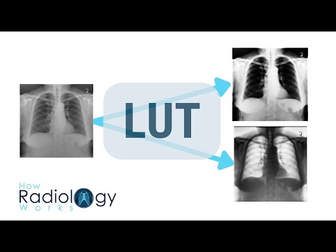 Видео: Справочные таблицы в радиологии (LUT)