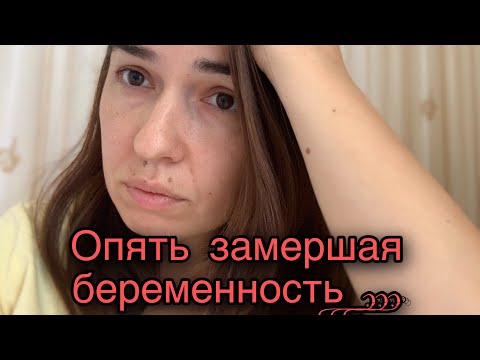 Видео: Две замерших беременности подряд, мой низкий рост хгч