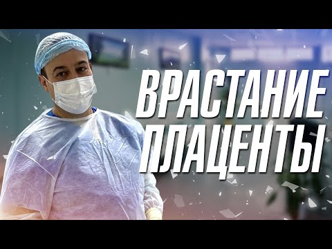 Видео: Врастание плаценты. д.м.н. Оводенко Дмитрий Леонидович. Москва.