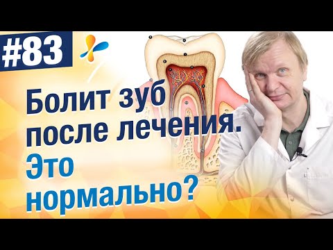 Видео: Почему болит зуб после лечения? Что делать?