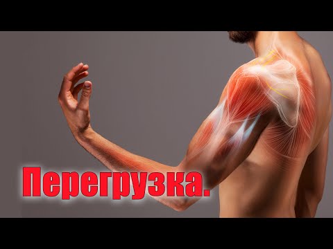 Видео: Гипертонус мышцы.Что это такое?