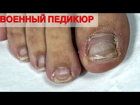 Видео: ПЕДИКЮР ОНЛАЙН. Виктория Авдеева