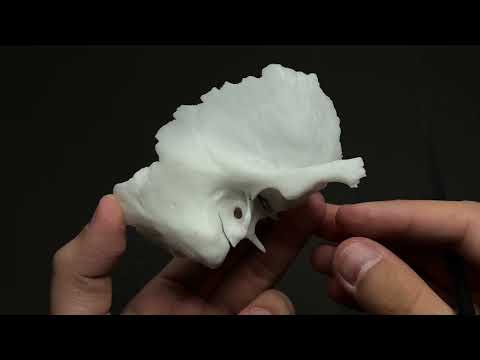 Видео: Самай сүйек|Височная кость|Os temporale