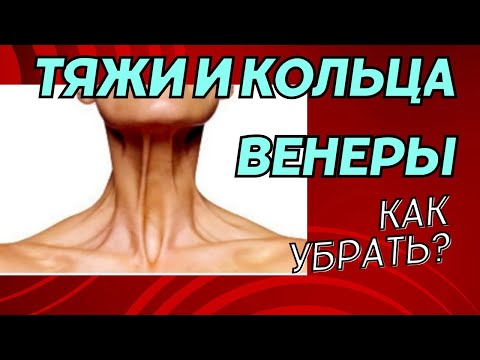 Видео: Кольца Венеры и тяжи на шее. Как бороться?