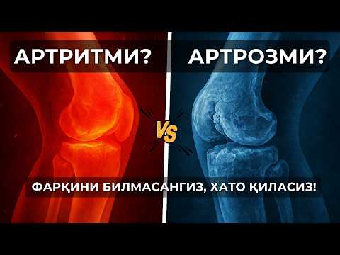 Видео: Артрит ва артроз фарқи | Тизза оғриғи белгиси ва даволаш усули