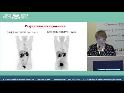 Видео: ПЭТ-КТ с 18F-ДОФА в диагностике нейроэндкринных опухолей (Рыжкова Д.В.)