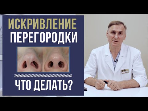 Видео: ИСКРИВЛЕНИЕ ПЕРЕГОРОДКИ НОСА ❗️КАК УЛУЧШИТЬ ДЫХАНИЕ?❗️