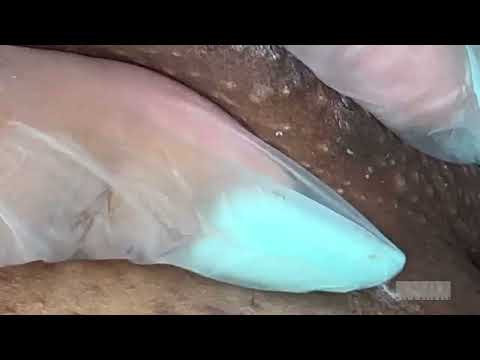 Видео: Извлечение из обнажёнки! Эпизод 14! Большой Поп!