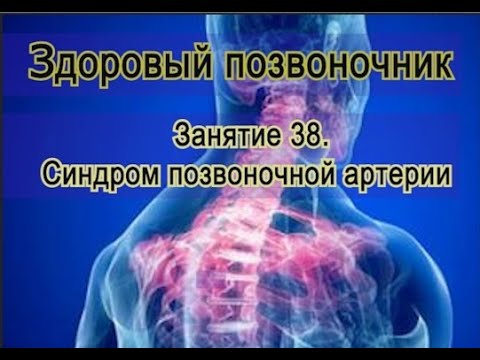 Видео: Занятие 38.  Синдром позвоночной артерии как осложнение больного позвоночника.
