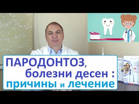 Видео: ПАРОДОНТОЗ, кровоточивость десен – как лечить. Причины болезней полости рта - неизвестные факты.