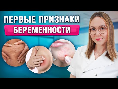 Видео: Как узнать о беременности ДО ЗАДЕРЖКИ? Ранние симптомы беременности