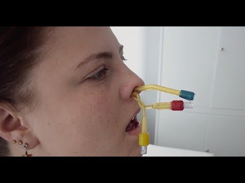 Видео: Лечение гайморита. Реальное видео без купюр. Новая техника проведения ЯМИК процедуры