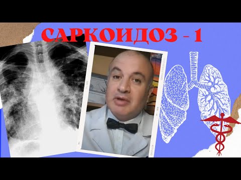 Видео: САРКОИДОЗ легких - 1. От этиологии до диагностики неказеозных гранулем