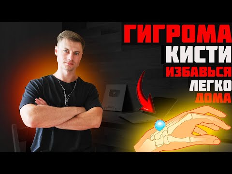 Видео: Гигрома кисти. Избавься легко!