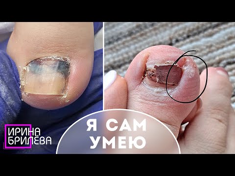 Видео: Это видео НЕ ДОЛЖНО было попасть на YouTube 🌸 Как "Я САМ" умею 🌸 ПЕДИКЮР 🌸 Ирина Брилёва