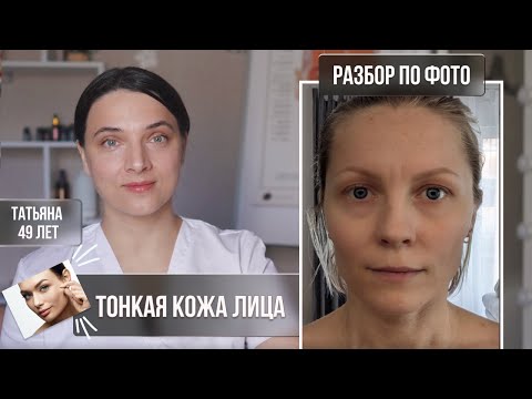 Видео: Тонкая кожа лица. Убираем межбровку. Мои рекомендации