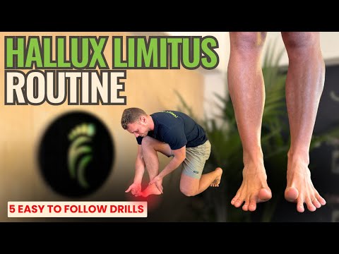 Видео: 5-минутная программа упражнений для Hallux Limitus | 5 основных упражнений