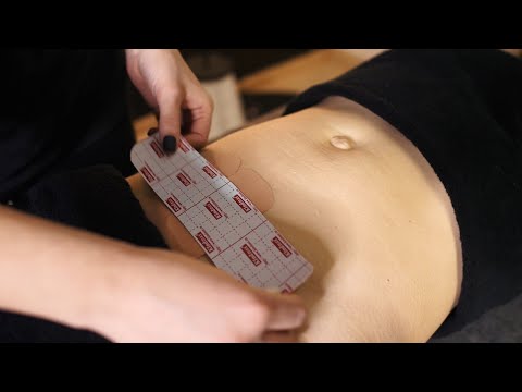 Видео: ТЕЙПИРОВАНИЕ ШРАМОВ И РУБЦОВ