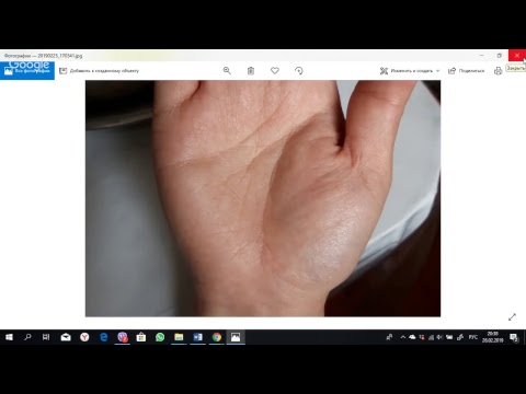 Видео: Пример падающей линии головы