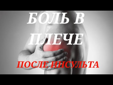 Видео: Я БЫ ОТДАЛ ВСЕ ЧТОБ УЗНАТЬ ОБ ЭТОМ 3 ГОДА НАЗАД  БОЛЬ В ПЛЕЧЕ ПОСЛЕ ИНСУЛЬТА