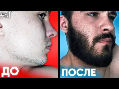 Видео: Борода С НУЛЯ всего за 5 месяцев / Вот что творит Ксиноксин