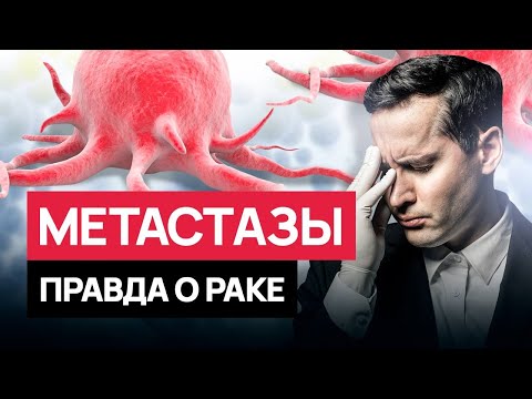 Видео: Рак дал метастазы - какой прогноз и есть ли шанс на излечение. #онкология #рак #cancer