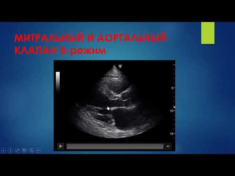 Видео: УЗД приобр пороков АК Ерошенко О Л