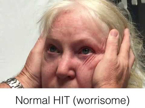 Видео: Экзамен HINTS