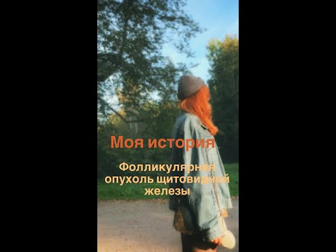 Видео: Фолликулярная опухоль щитовидной железы.Рак или нет?Моя история